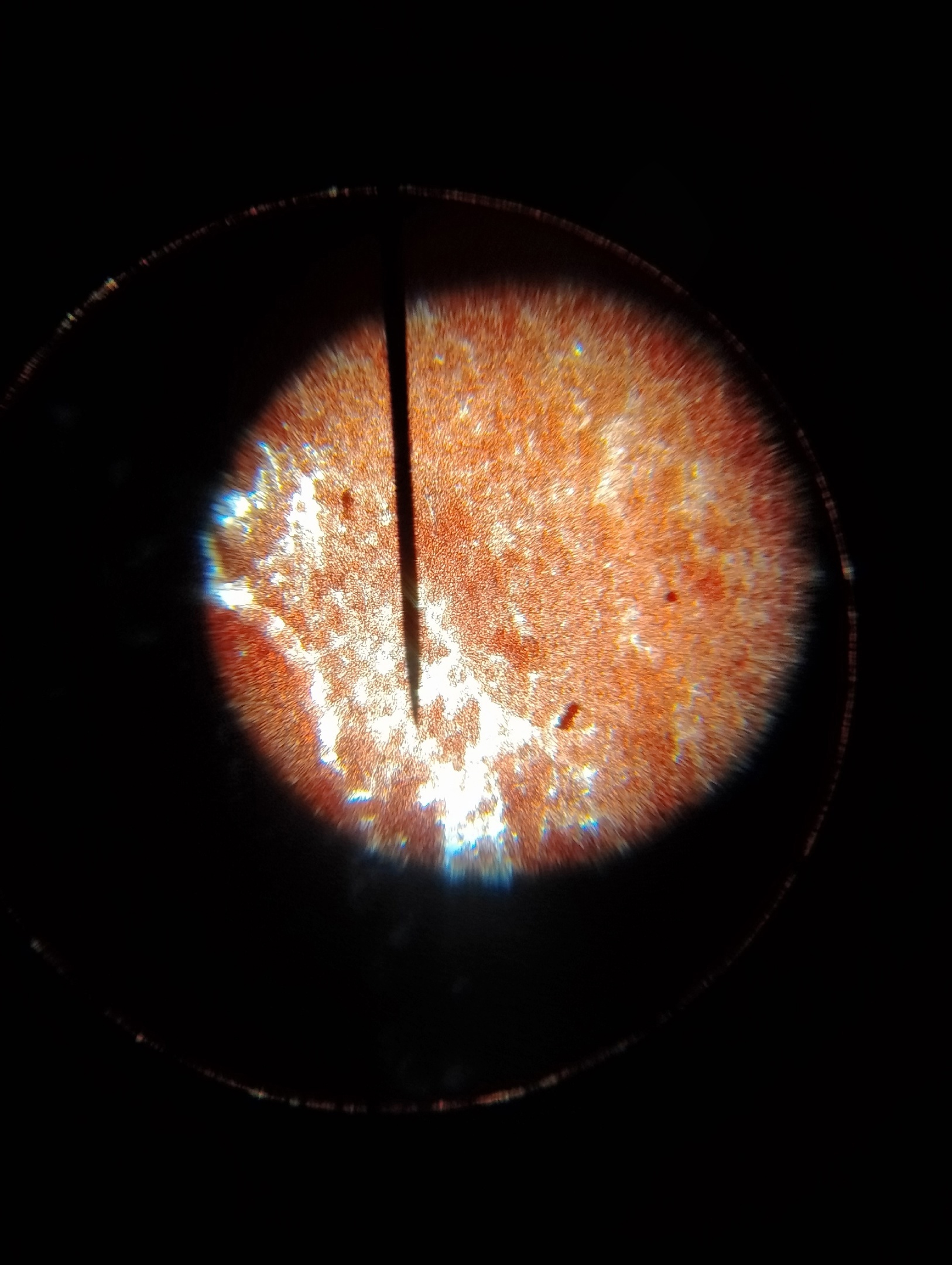 Изучение микропрепаратов крови под микроскопом..